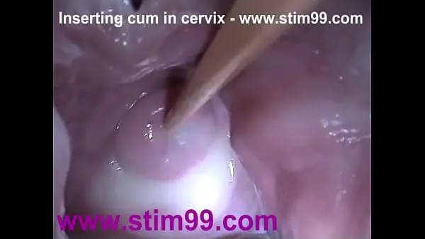 Watch Insertion Semen Cum in Cervix Wide Stretching Pussy Speculum total Videos