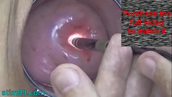 Watch Endoscopic Camera in Cervix watch inside my Womb and Vagina. Inspection testing exam of wife by extreme doctor gynecologist total Videos