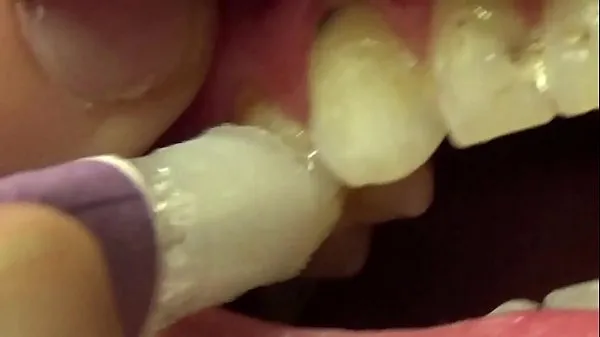Applying Whitening Paste To Her Filthy Teeth toplam Videoyu izleyin