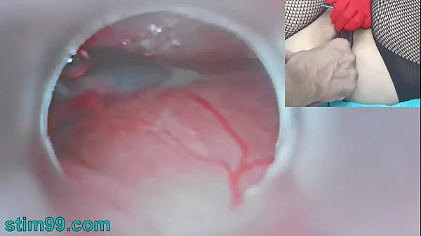 Watch Uncensored Japanese Insemination with Cum into Uterus and Endoscope Camera by Cervix to watch inside womb total Videos